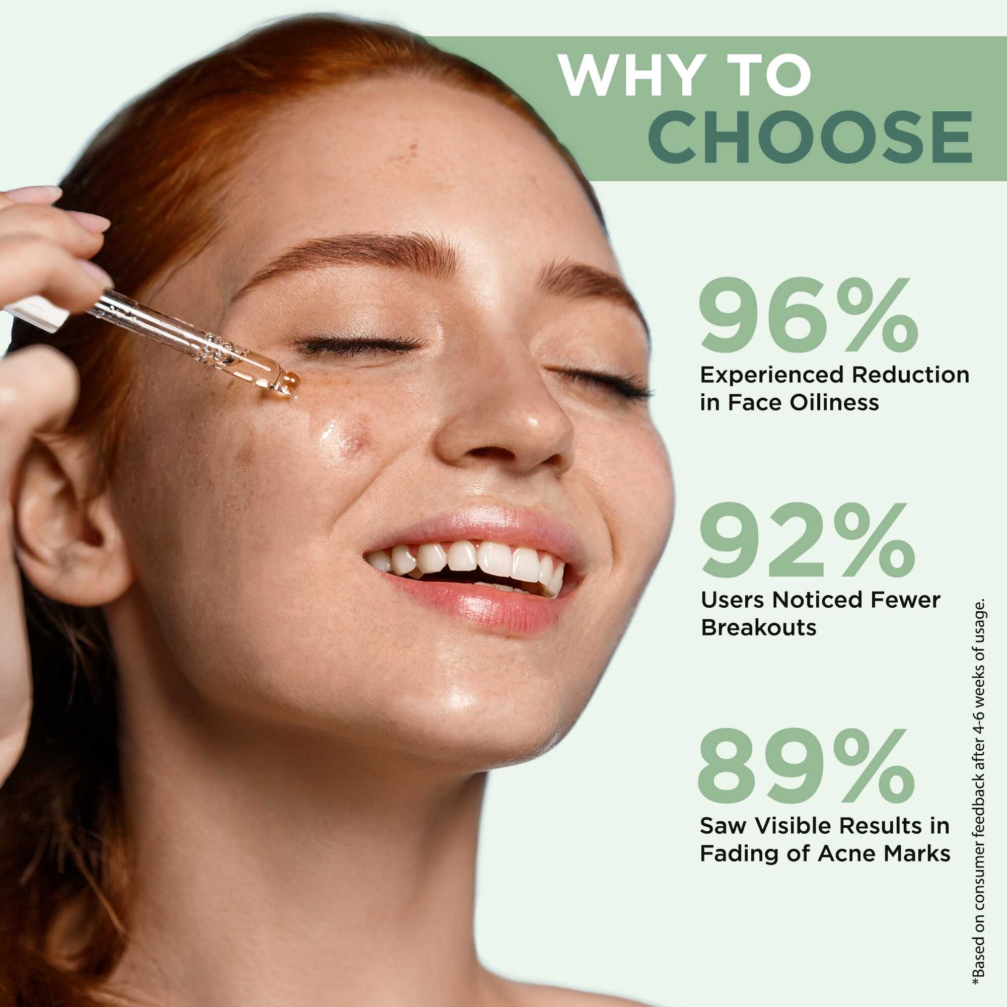 5% Niacinamide Acne Control Face Serum