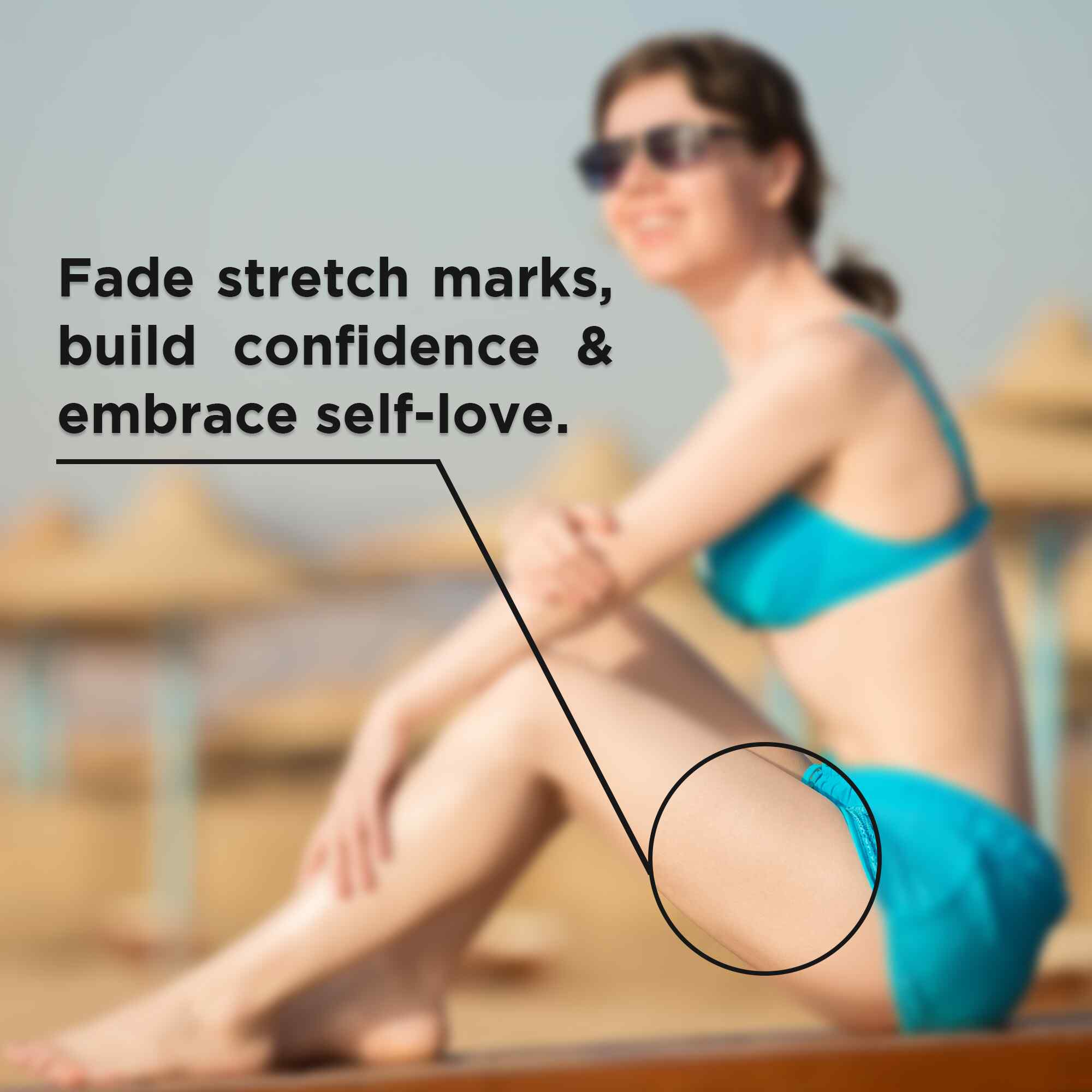 stretch marks roll on