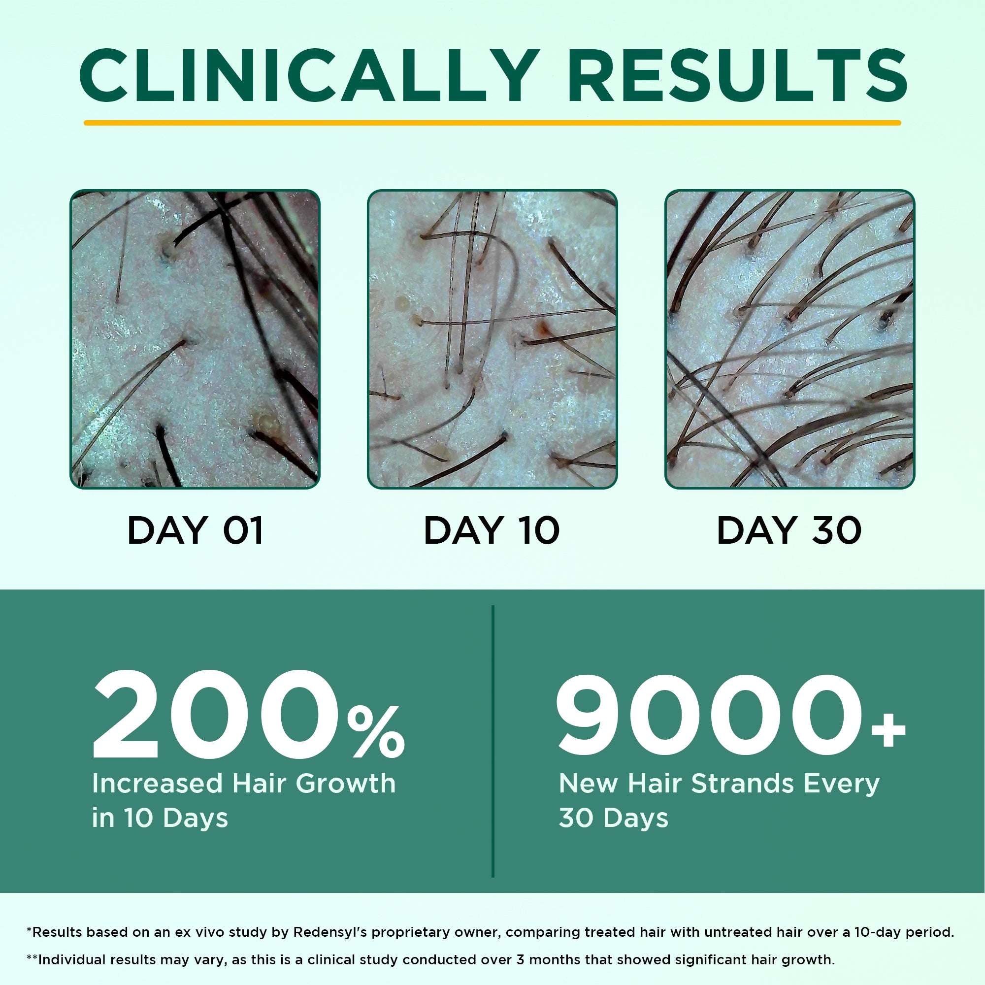 Hair Growth Oil - Rosemary & Ginger Oil