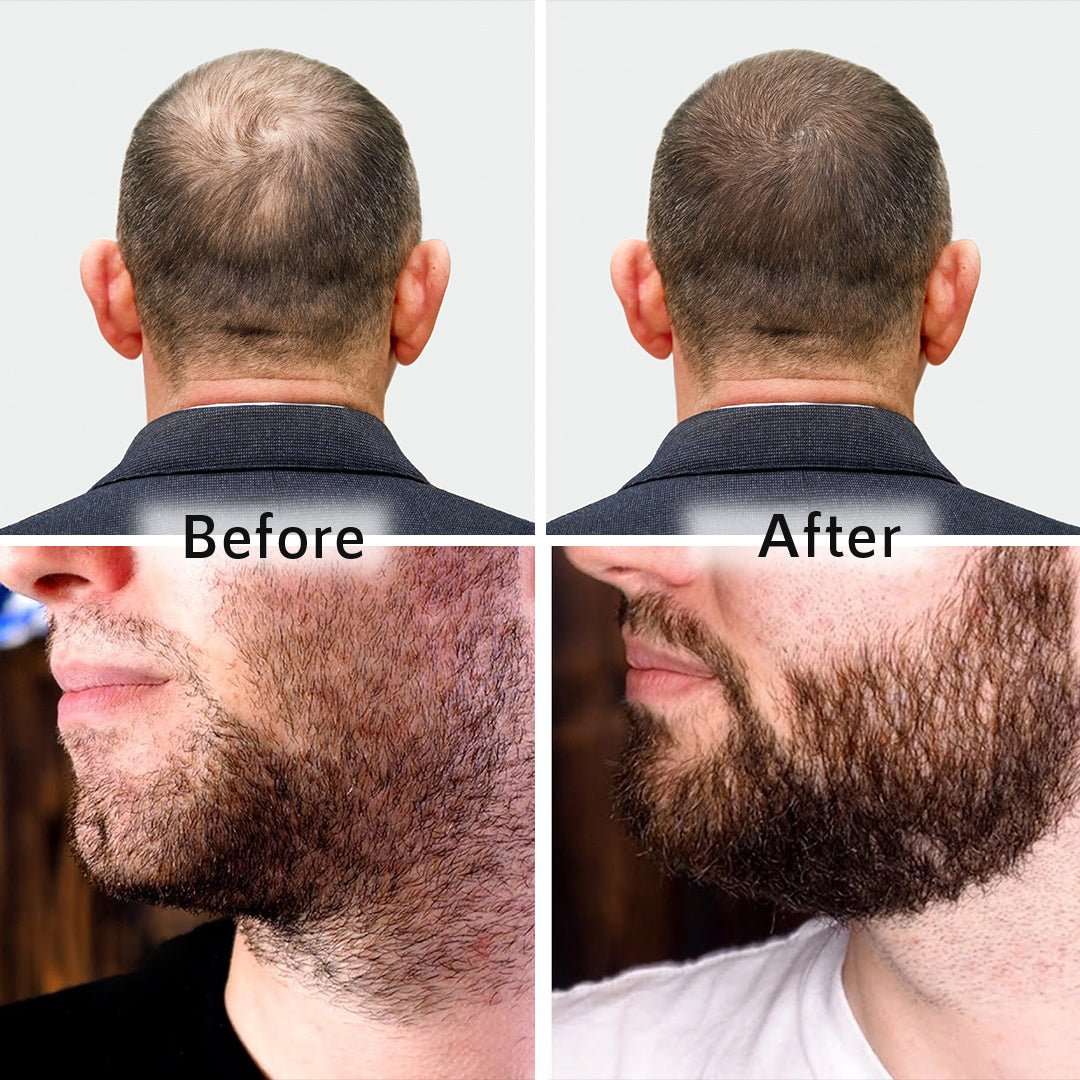 Hair Growth Serum 2.0 for Beard & Scalp