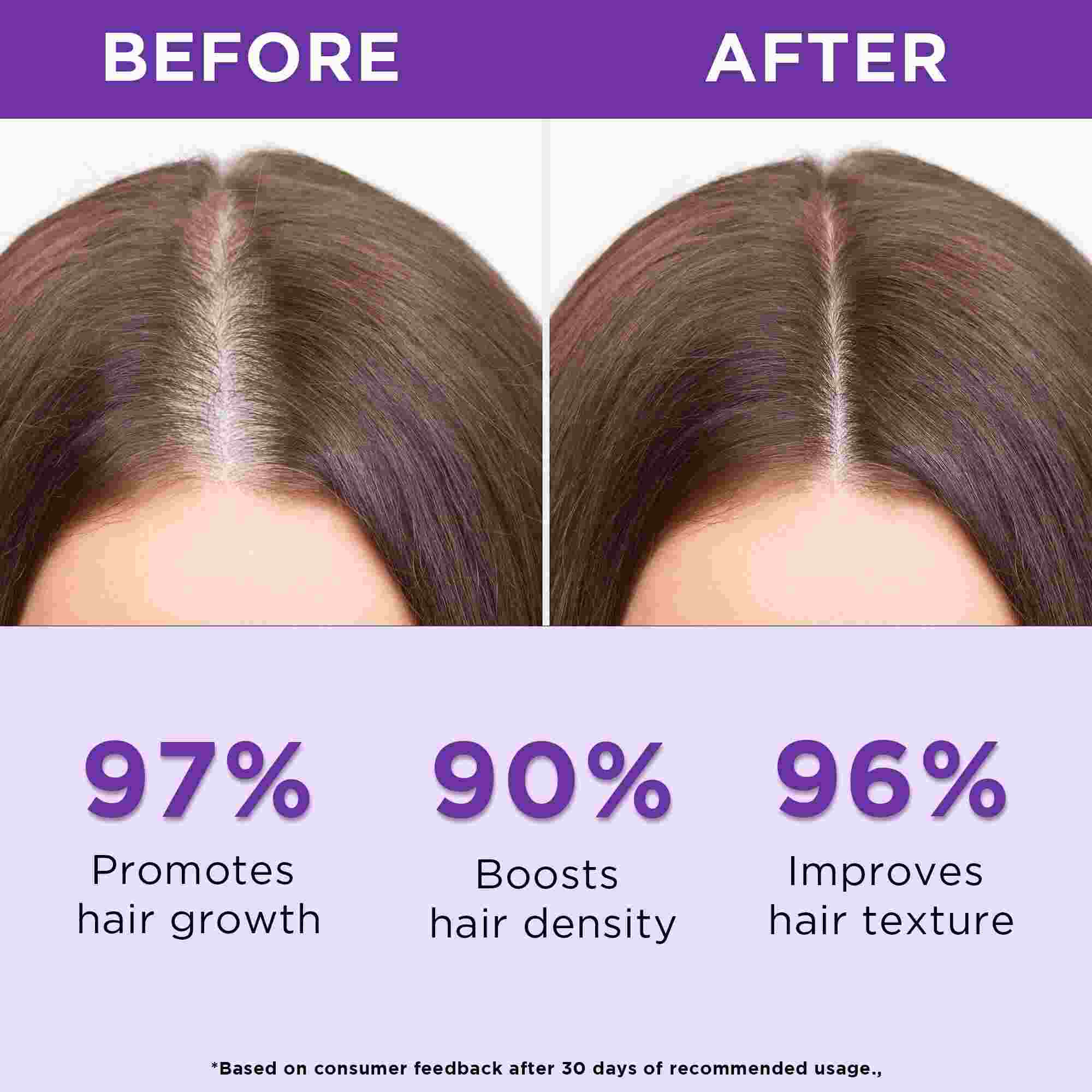 Rosemary Water Spray for Hair Growth