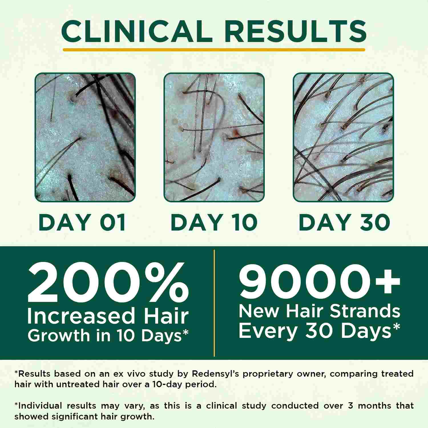 3% Redensyl + 3% Procapil Hair Growth Serum
