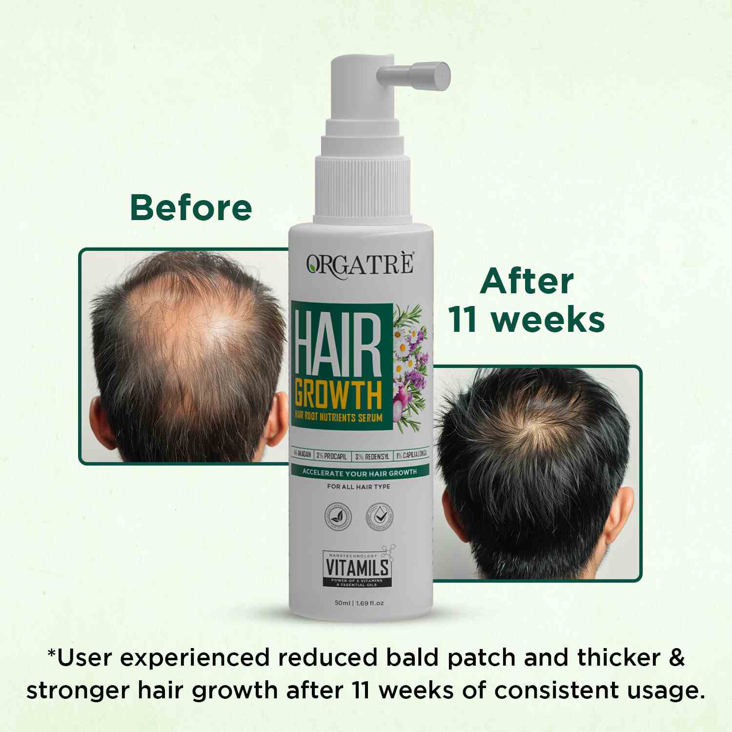 3% Redensyl + 3% Procapil Hair Growth Serum